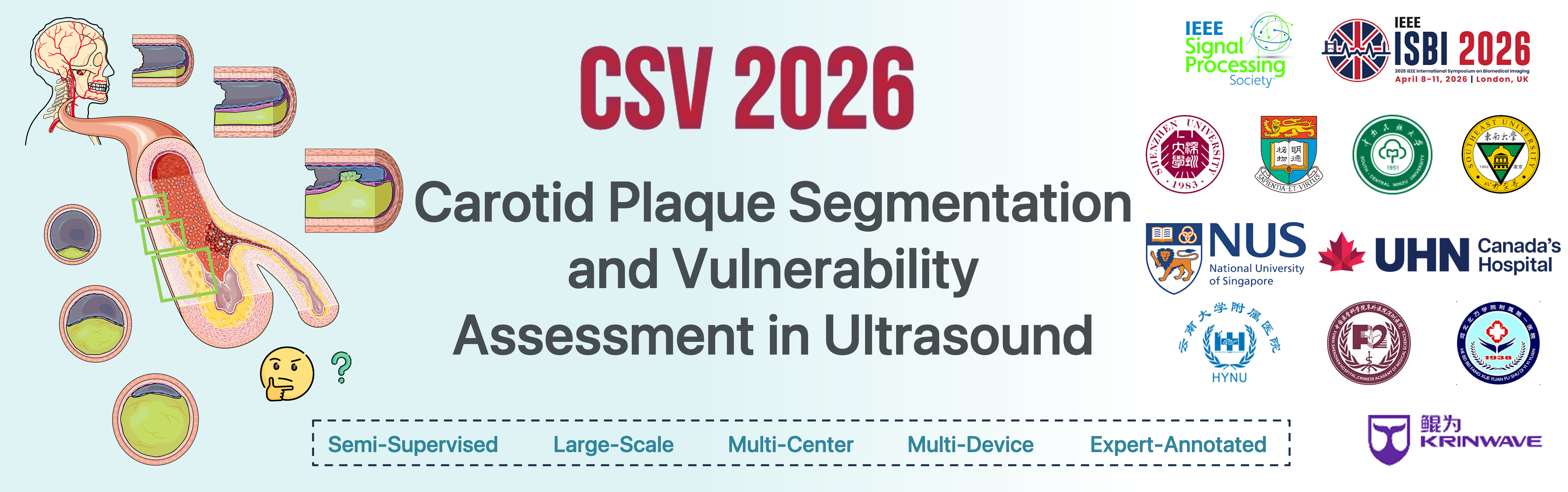 CSV 2026 Challenge banner